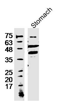 TREX2 Antibody in Immunohistochemistry (Paraffin) (IHC (P))