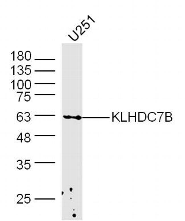 KLHDC7B Antibody in Western Blot (WB)