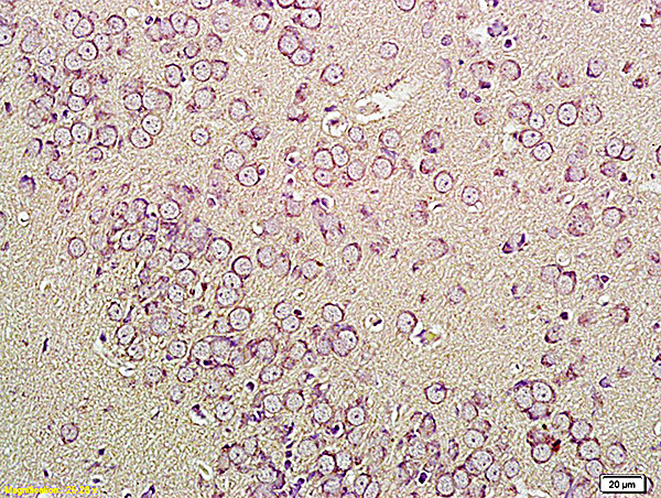 CNR1/CB1 Antibody in Immunohistochemistry (Paraffin) (IHC (P))