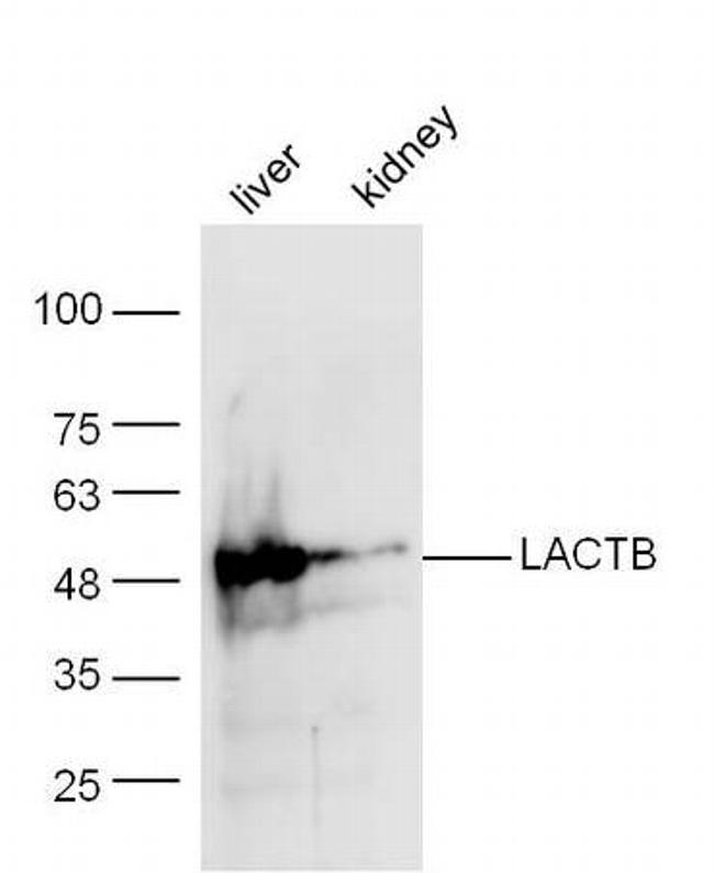 LACTB Antibody in Western Blot (WB)