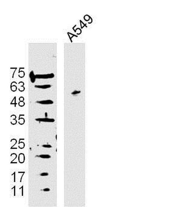 DAPK3 Antibody in Western Blot (WB)