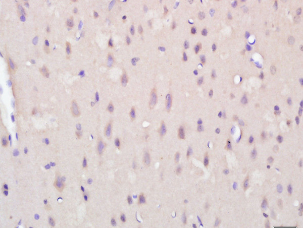 KCTD19 Antibody in Immunohistochemistry (Paraffin) (IHC (P))