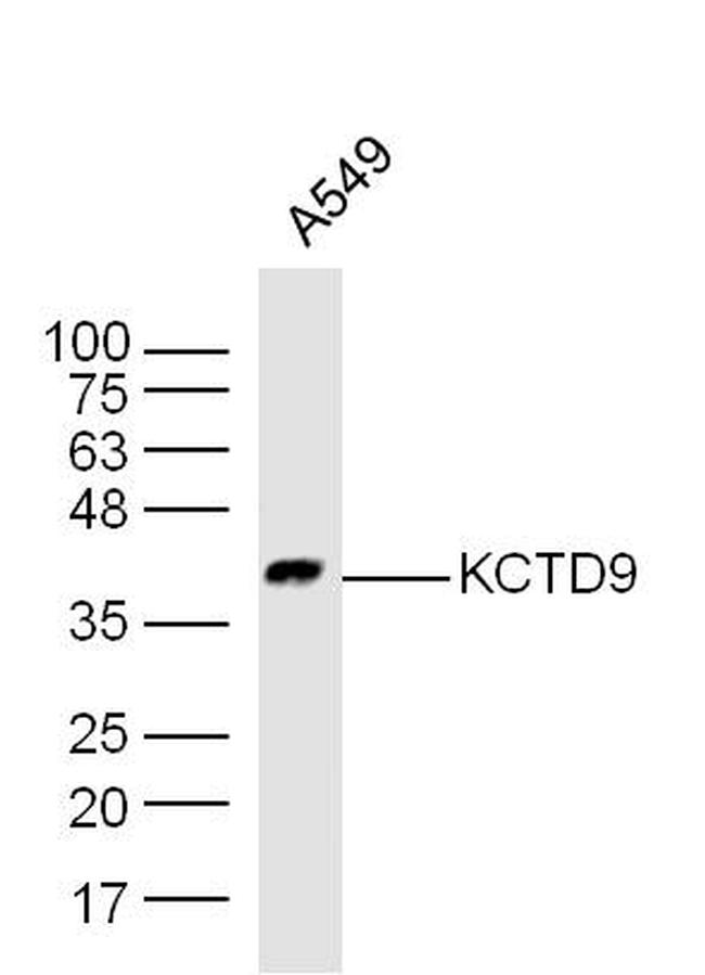 KCTD9 Antibody in Western Blot (WB)