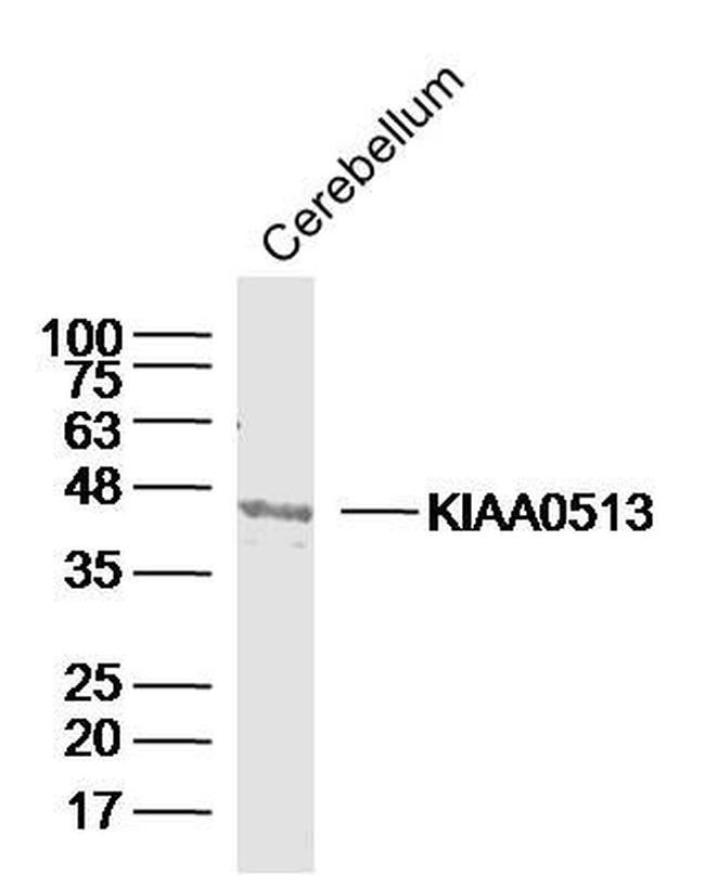 KIAA0513 Antibody in Western Blot (WB)