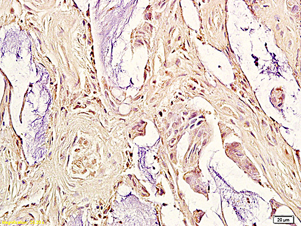 ox-LDL Antibody in Immunohistochemistry (Paraffin) (IHC (P))