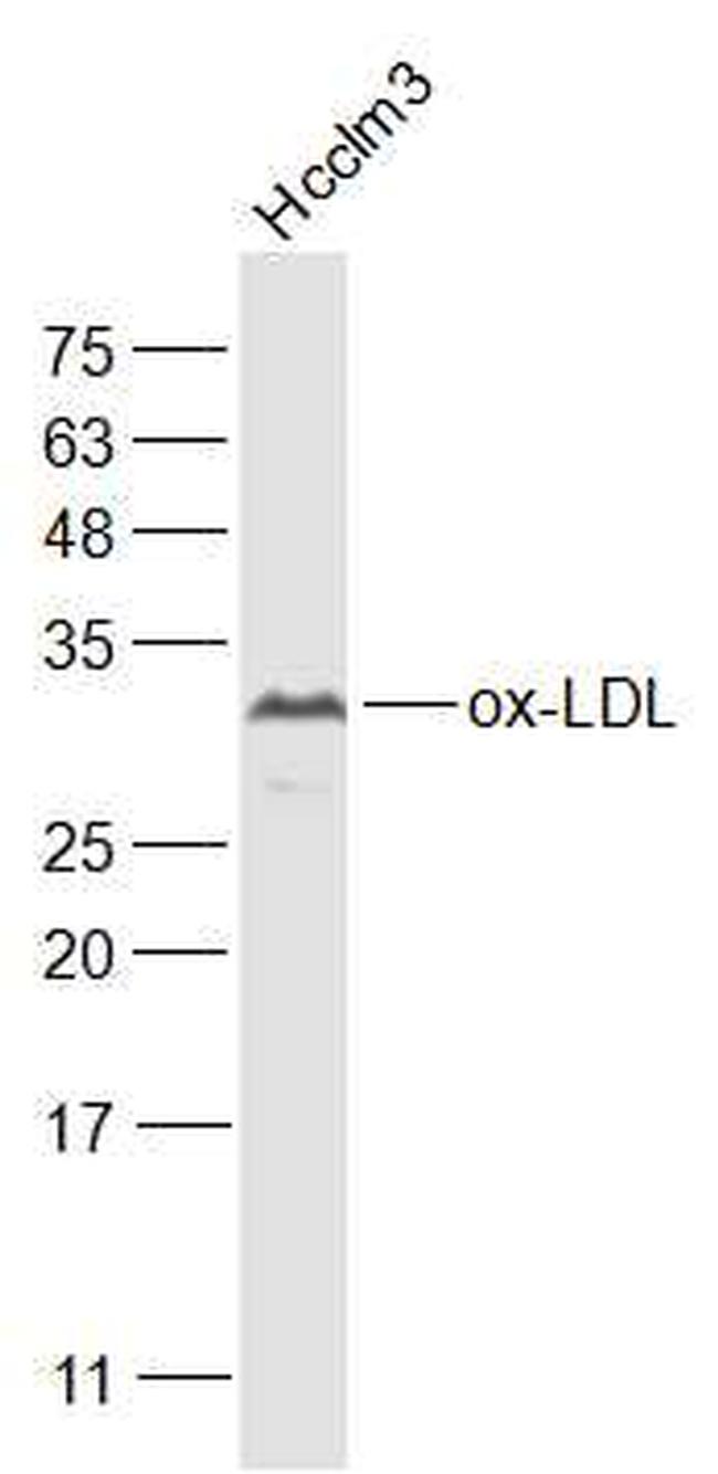 ox-LDL Antibody in Western Blot (WB)