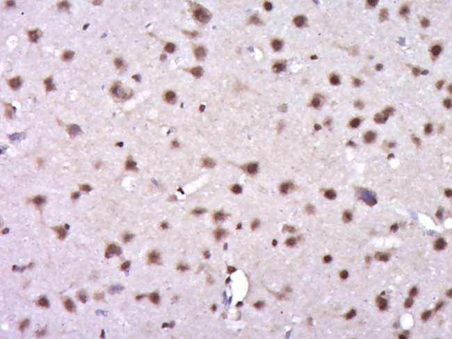 Phospho-KAT5 (Ser86) Antibody in Immunohistochemistry (Paraffin) (IHC (P))