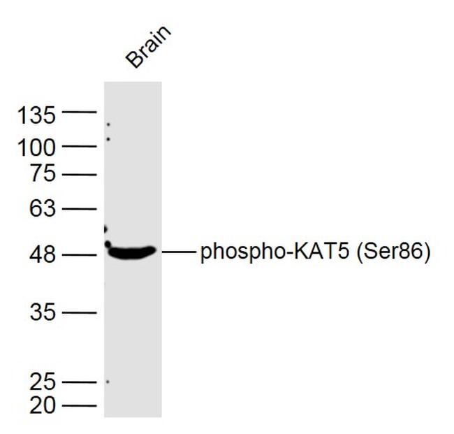 Phospho-KAT5 (Ser86) Antibody in Western Blot (WB)