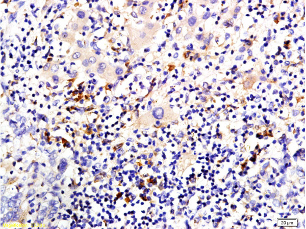 pan Cytokeratin Antibody in Immunohistochemistry (Paraffin) (IHC (P))