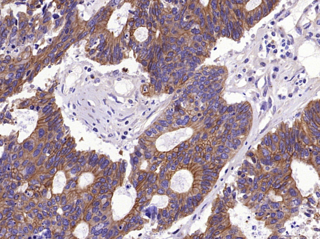 pan Cytokeratin Antibody in Immunohistochemistry (Paraffin) (IHC (P))