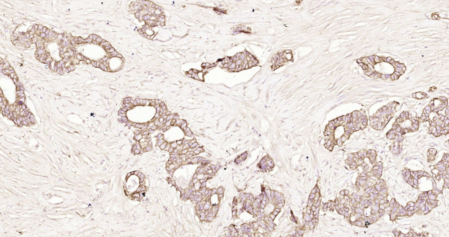 pan Cytokeratin Antibody in Immunohistochemistry (Paraffin) (IHC (P))