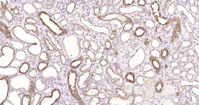 pan Cytokeratin Antibody in Immunohistochemistry (Paraffin) (IHC (P))