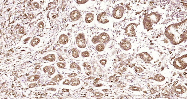 pan Cytokeratin Antibody in Immunohistochemistry (Paraffin) (IHC (P))