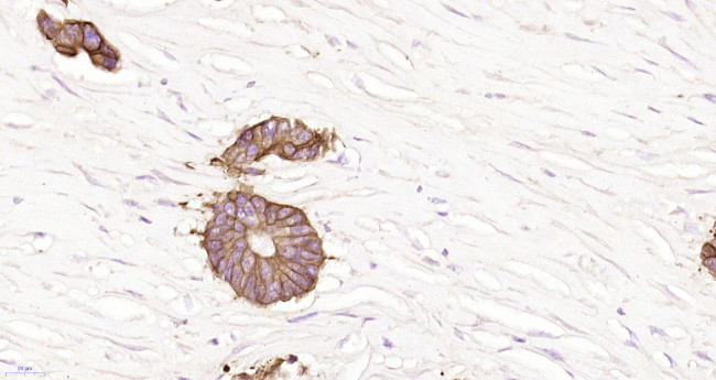 pan Cytokeratin Antibody in Immunohistochemistry (Paraffin) (IHC (P))