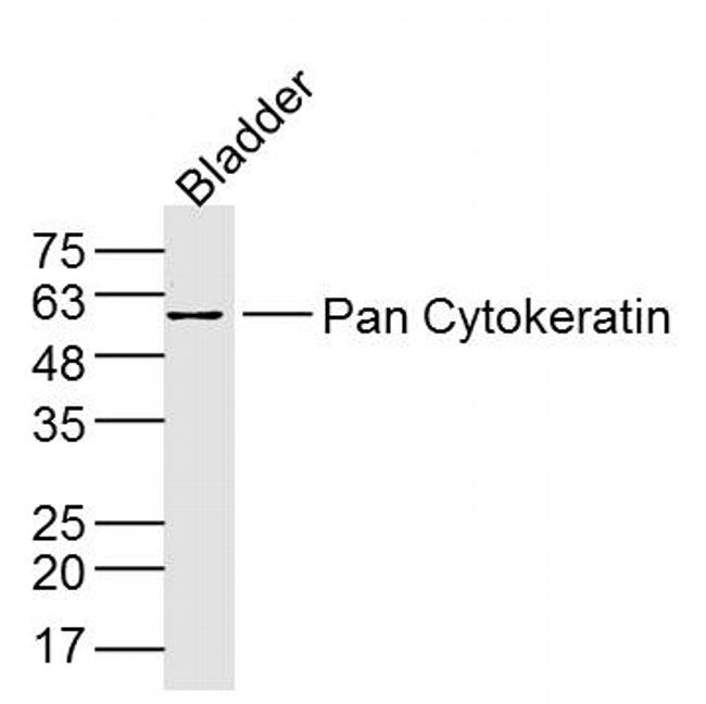 pan Cytokeratin Antibody in Western Blot (WB)