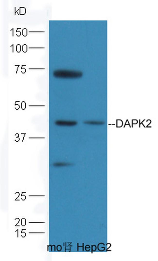 DAPK1/2 Antibody in Western Blot (WB)