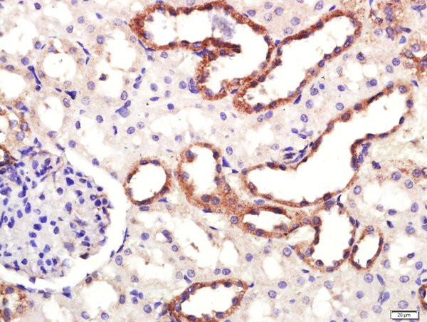 DAT/Dopamine transporter Antibody in Immunohistochemistry (Paraffin) (IHC (P))