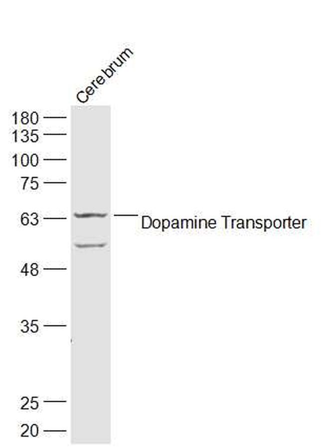 DAT/Dopamine transporter Antibody in Western Blot (WB)