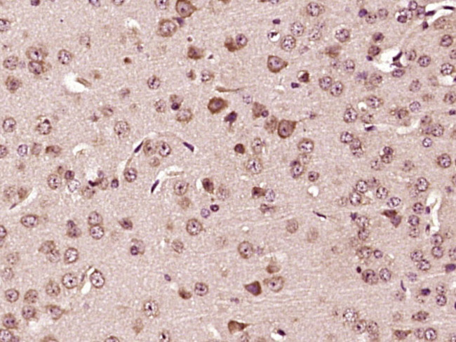 TPA Antibody in Immunohistochemistry (Paraffin) (IHC (P))