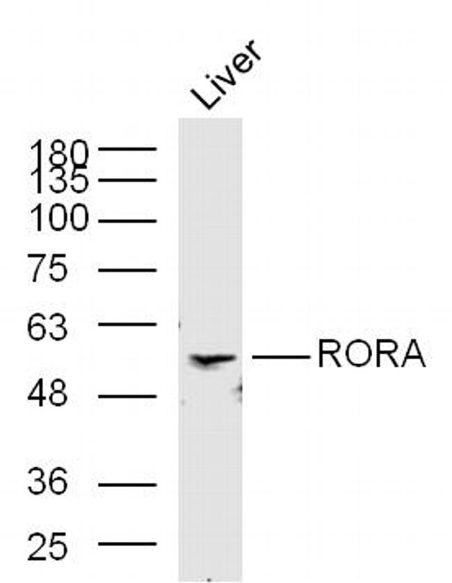 RORA Antibody in Western Blot (WB)