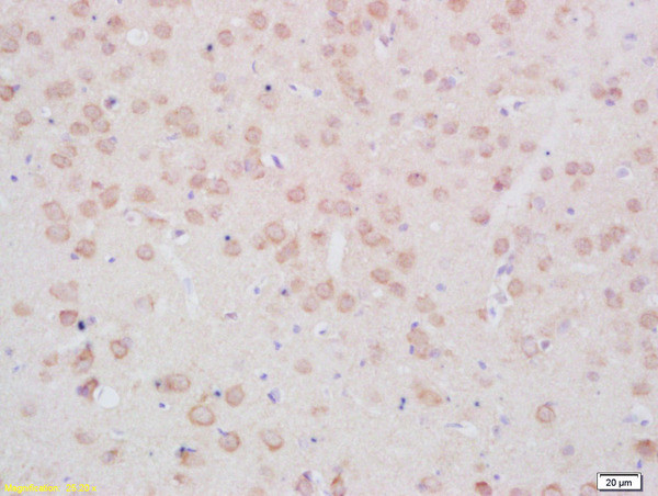 Phospho-TPH2 (Ser19) Antibody in Immunohistochemistry (Paraffin) (IHC (P))