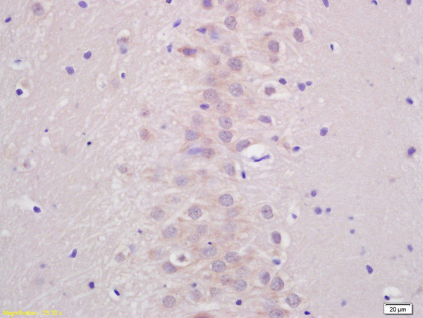 ATP7B Antibody in Immunohistochemistry (Paraffin) (IHC (P))