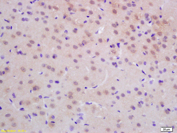 dUTPase Antibody in Immunohistochemistry (Paraffin) (IHC (P))