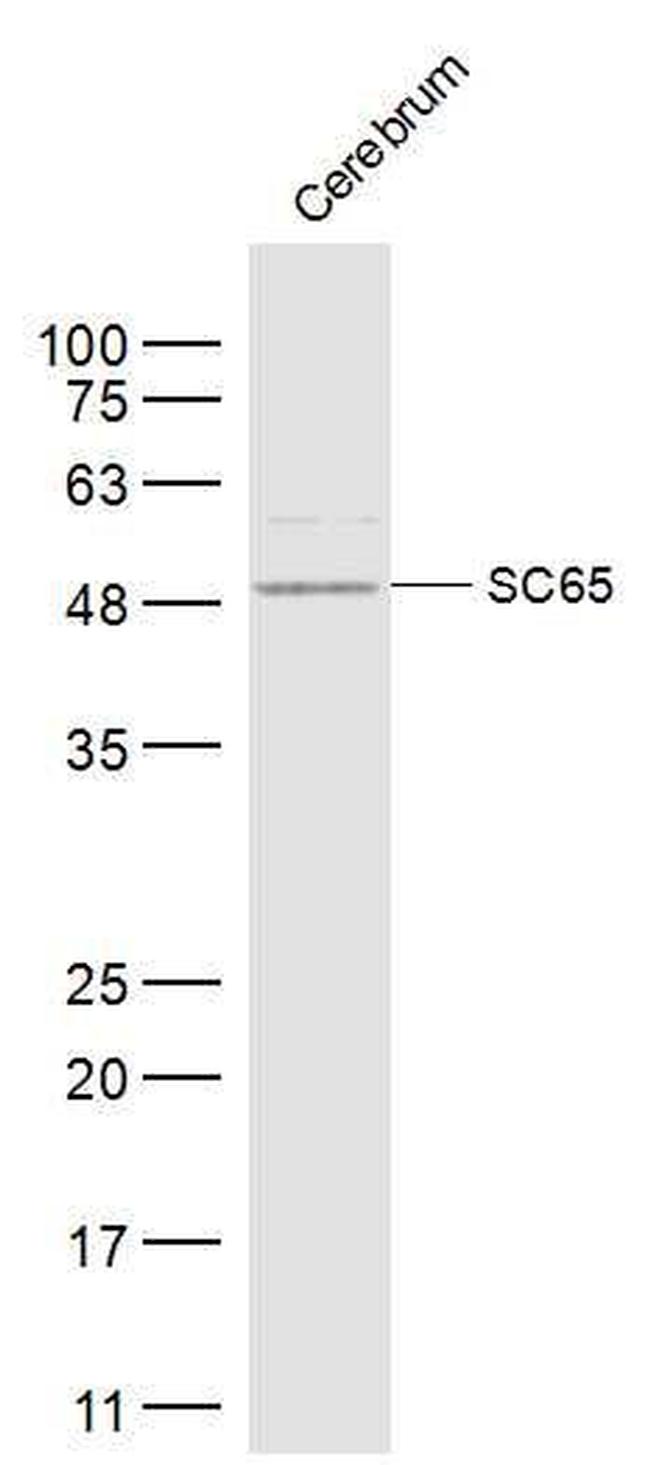 SC65 Antibody in Western Blot (WB)