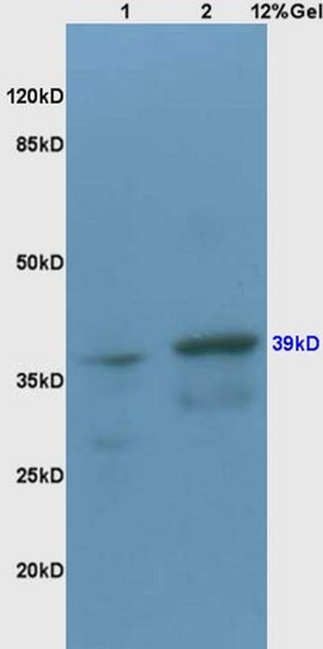 CX3CR1 Antibody in Western Blot (WB)