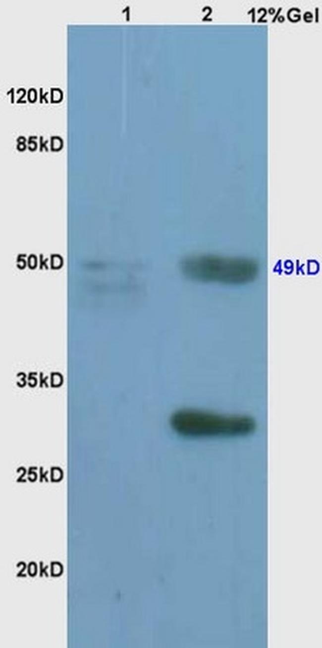 Phospho-c-Myc (Thr58, Ser62) Antibody in Western Blot (WB)