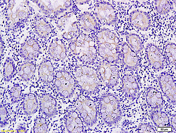 Phospho-c-Met (Tyr1365) Antibody in Immunohistochemistry (Paraffin) (IHC (P))