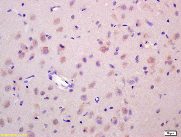 Wnt1 Antibody in Immunohistochemistry (Paraffin) (IHC (P))