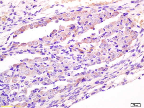 Wnt1 Antibody in Immunohistochemistry (Paraffin) (IHC (P))