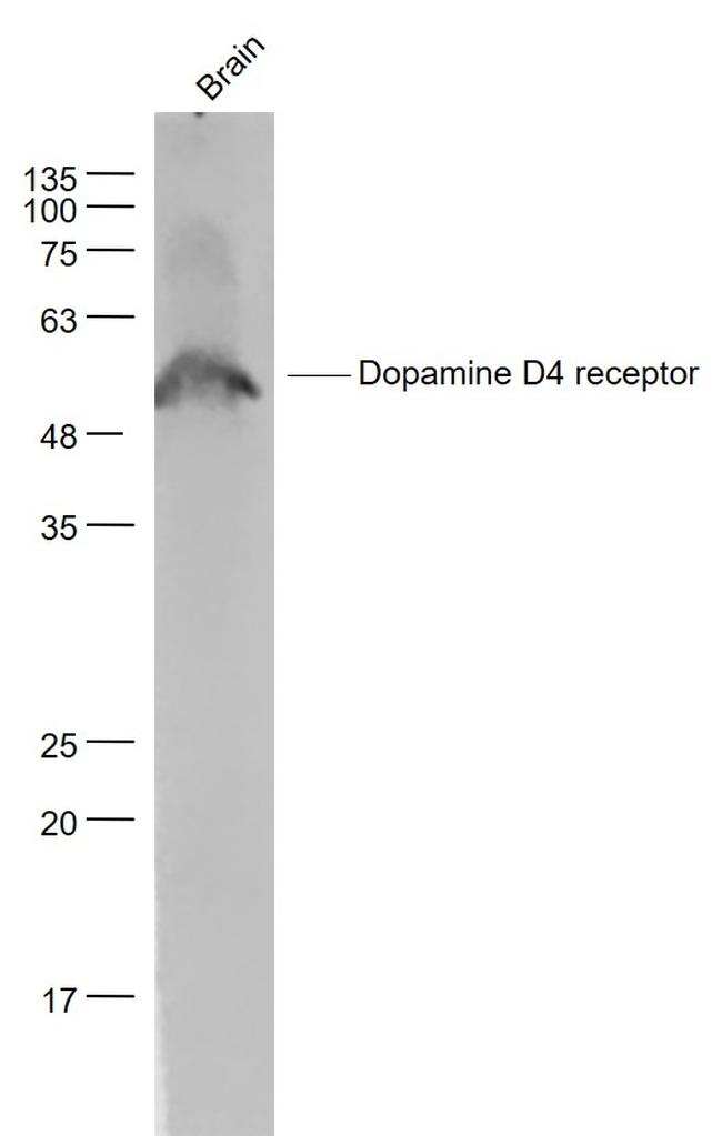 DRD4 Antibody in Western Blot (WB)