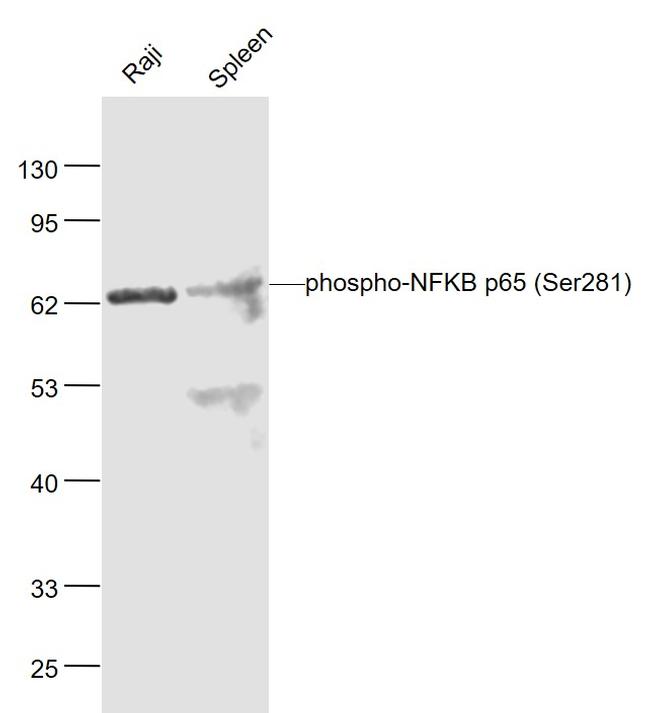 Phospho-NFKB p65 (Ser281) Antibody in Western Blot (WB)