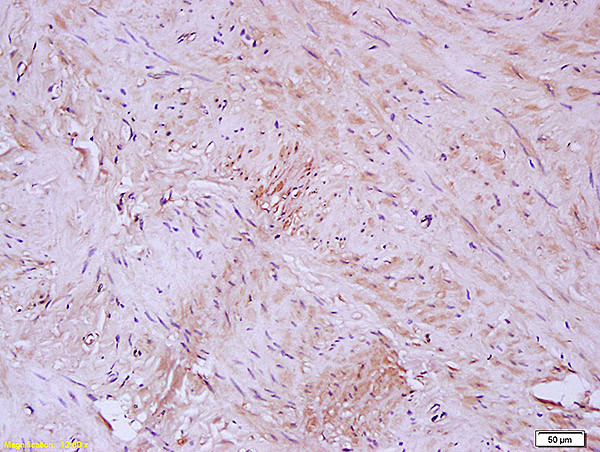 Elastin Antibody in Immunohistochemistry (Paraffin) (IHC (P))