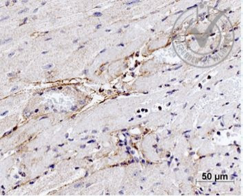 Elastin Antibody in Immunohistochemistry (Paraffin) (IHC (P))