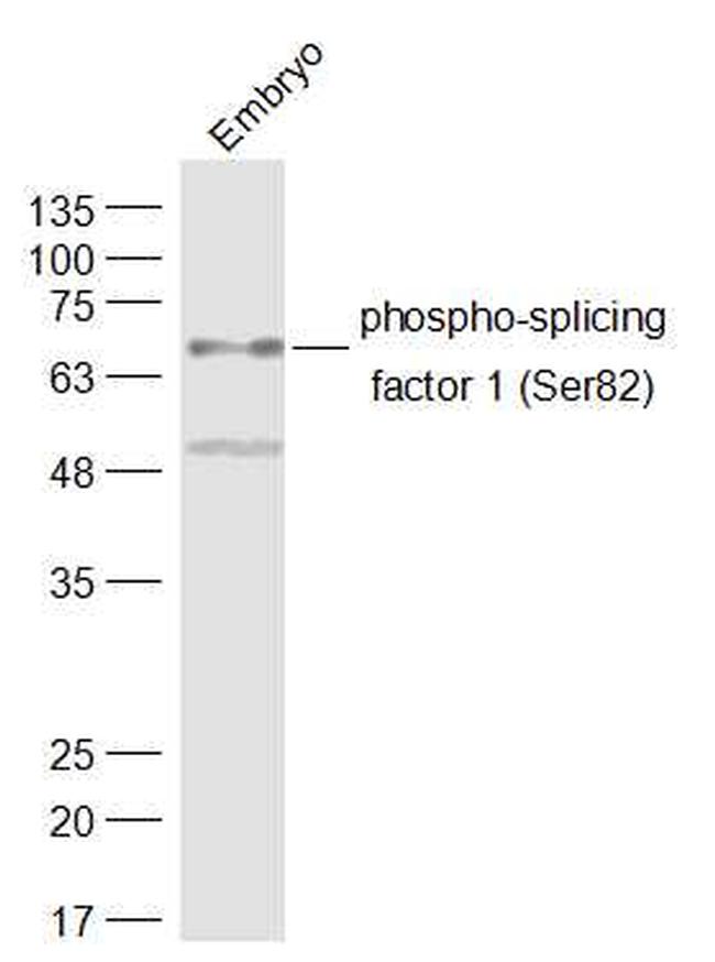 Phospho-Splicing factor 1 (Ser82) Antibody in Western Blot (WB)