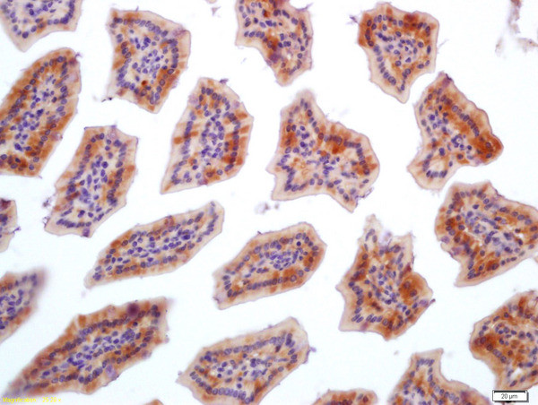 FGFBP1 Antibody in Immunohistochemistry (Paraffin) (IHC (P))