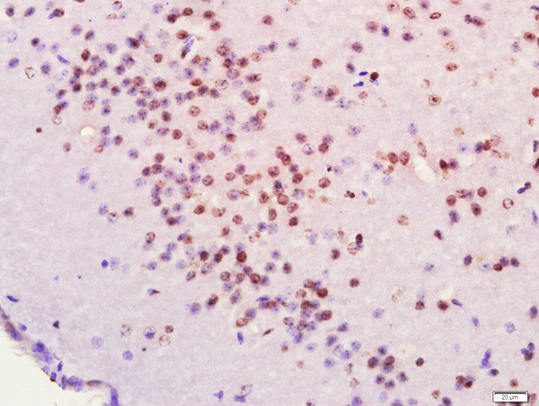 FOXJ1/HFH-4 Antibody in Immunohistochemistry (Paraffin) (IHC (P))