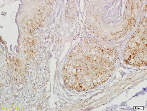 Gastrin receptor/GASR/CCKBR Antibody in Immunohistochemistry (Paraffin) (IHC (P))