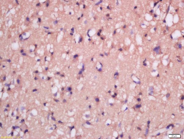 MSRB2 Antibody in Immunohistochemistry (Paraffin) (IHC (P))