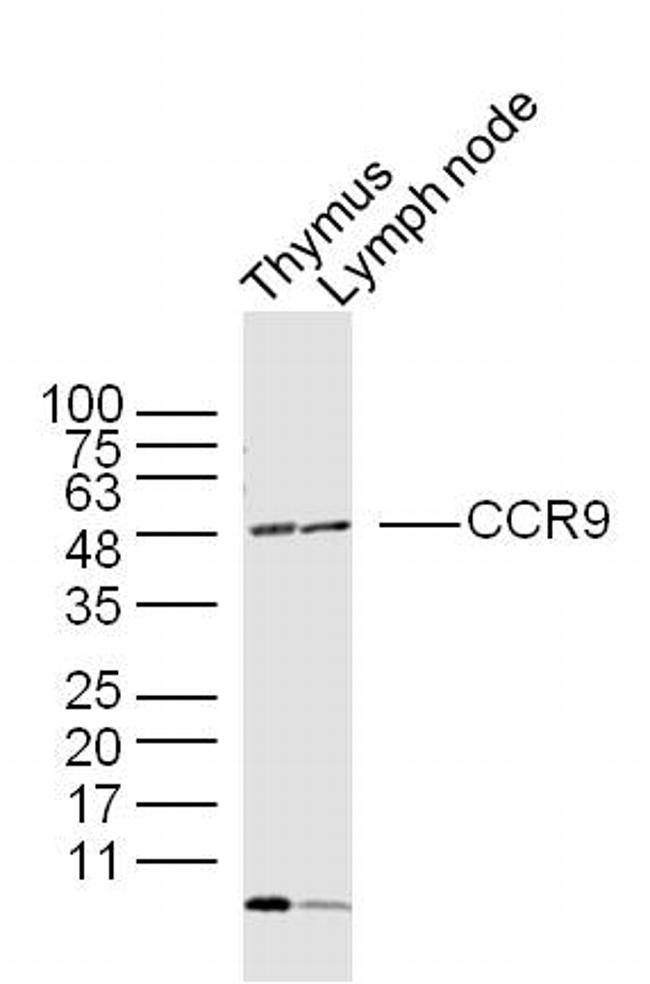 CCR9 Antibody in Western Blot (WB)