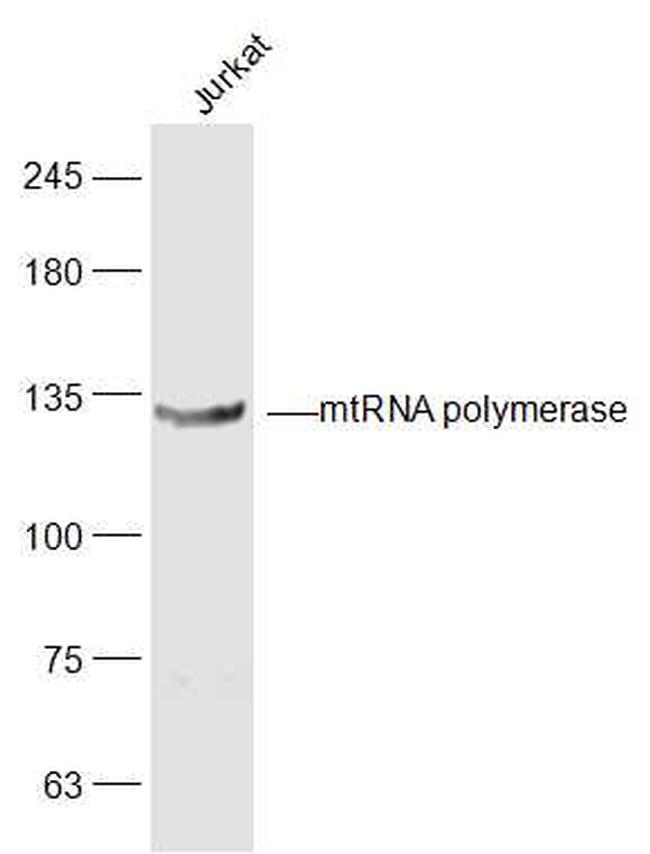 mtRNA polymerase Antibody in Western Blot (WB)