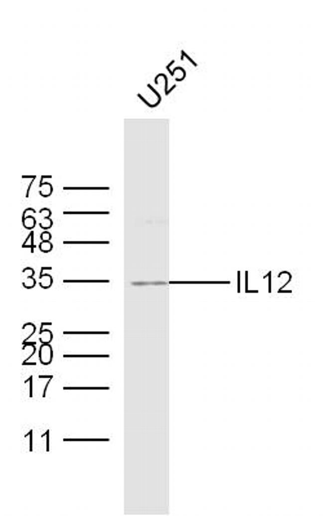 IL-12 Antibody in Western Blot (WB)