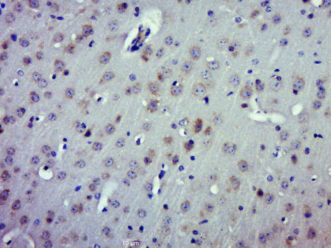 CRMP2 Antibody in Immunohistochemistry (Paraffin) (IHC (P))