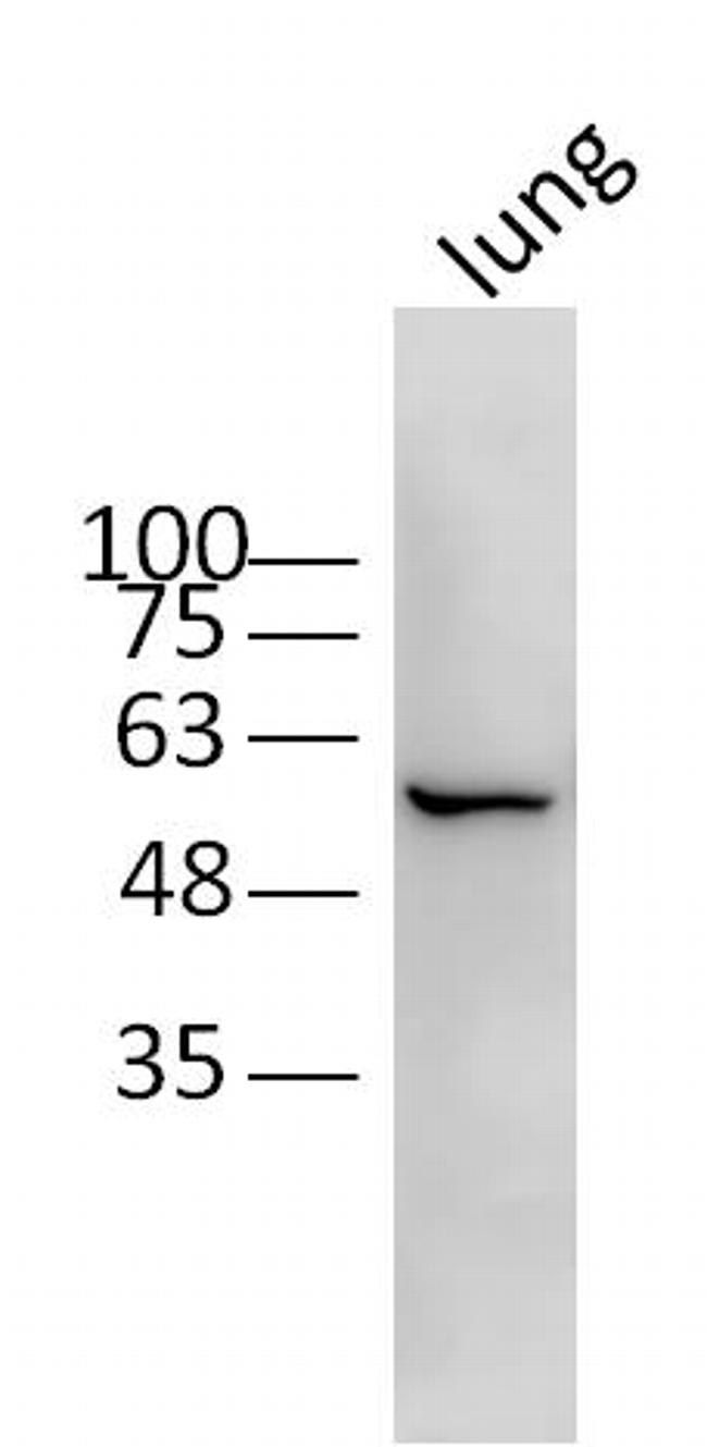 CRMP2 Antibody in Western Blot (WB)