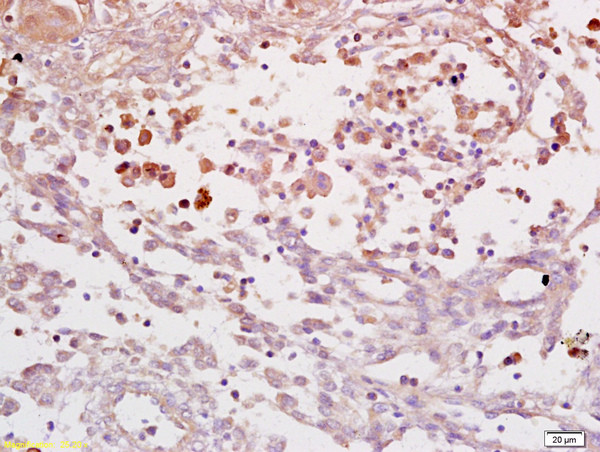 IL-6R alpha Antibody in Immunohistochemistry (Paraffin) (IHC (P))