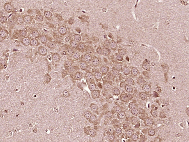 IL-6R alpha Antibody in Immunohistochemistry (Paraffin) (IHC (P))