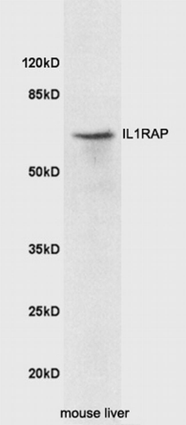 IL1RAP Antibody in Western Blot (WB)